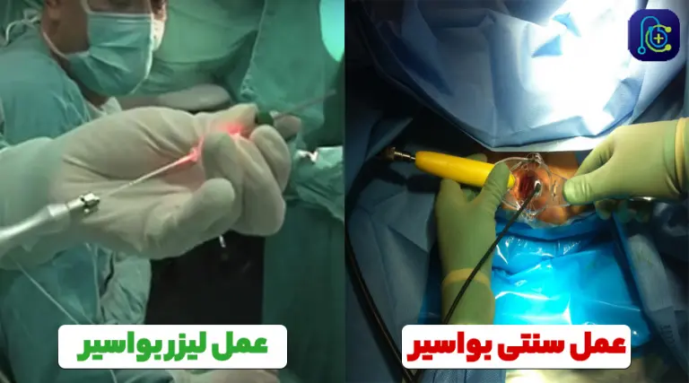 نوع عمل جراحی؛ سنتی یا لیزر